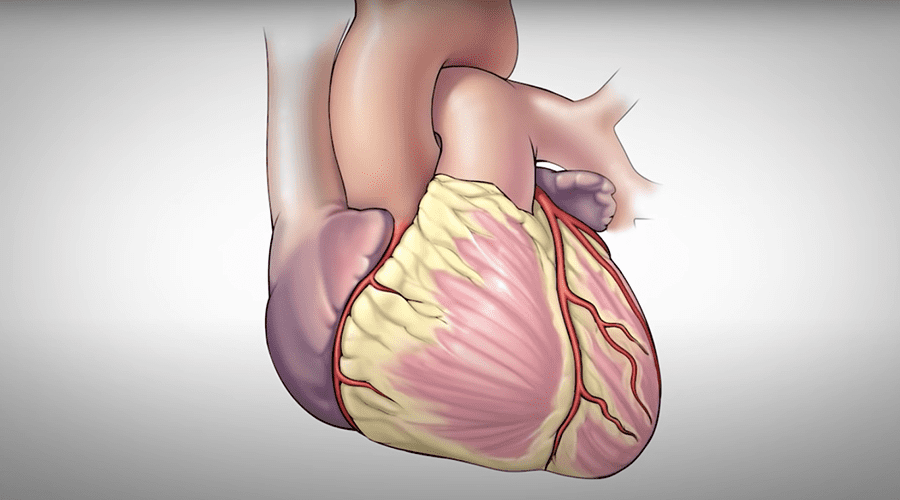 Coronary Artery Bypass Surgery - Heartbeats Charitable Trust